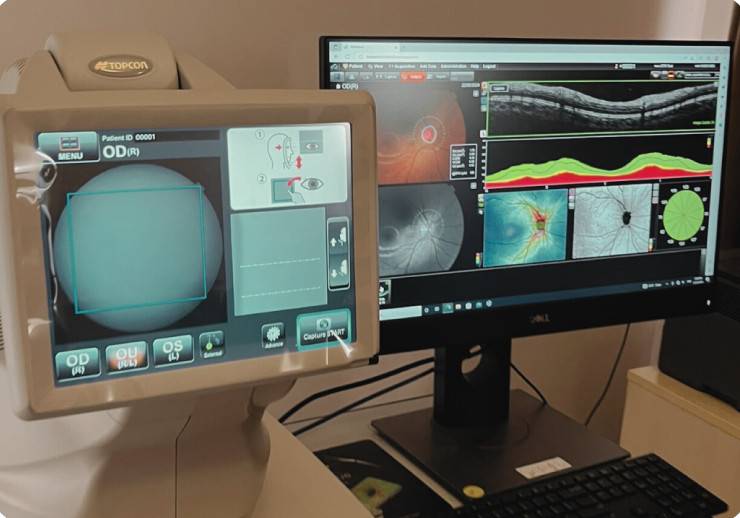 Optical Coherence Tomography (OCT)